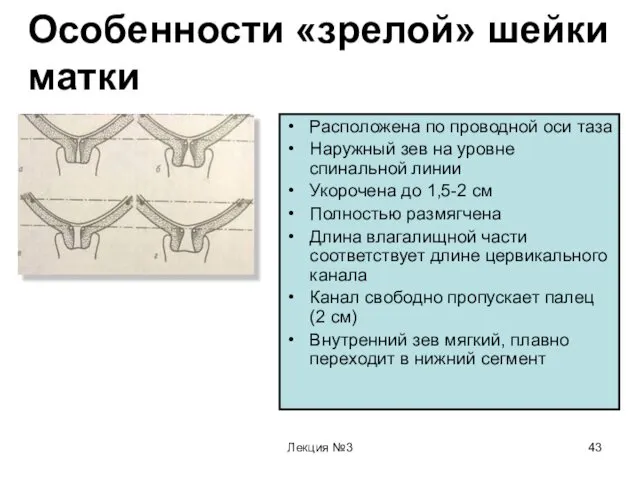 Лекция №3 Особенности «зрелой» шейки матки Расположена по проводной оси