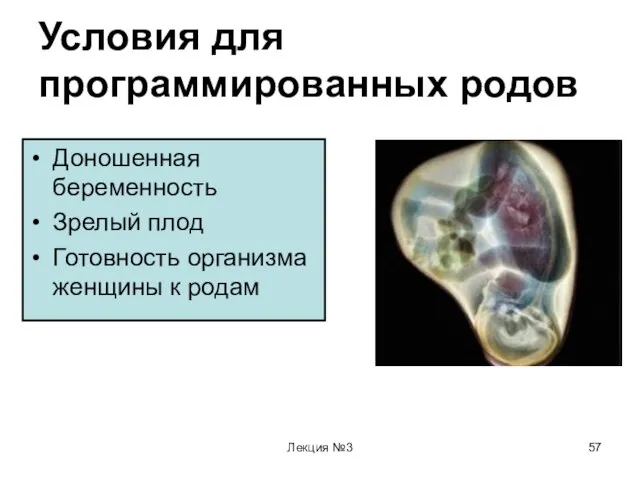 Лекция №3 Условия для программированных родов Доношенная беременность Зрелый плод Готовность организма женщины к родам