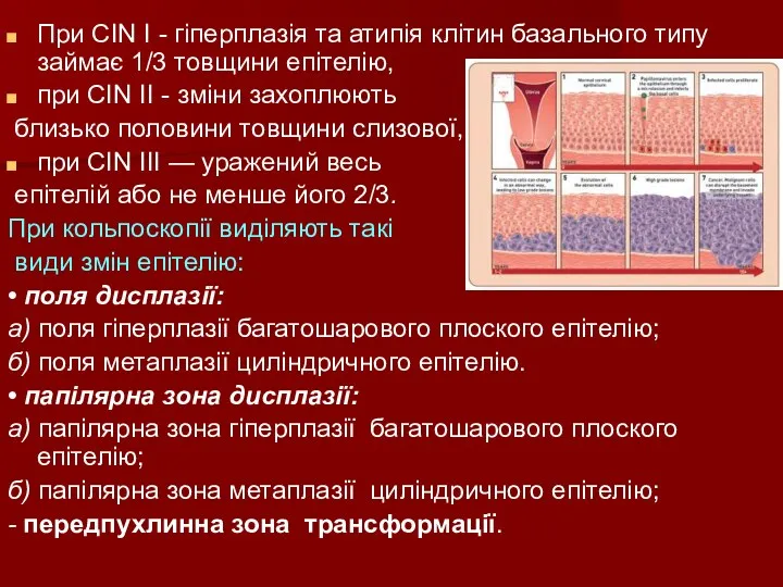 При CIN І - гіперплазія та атипія клітин базального типу