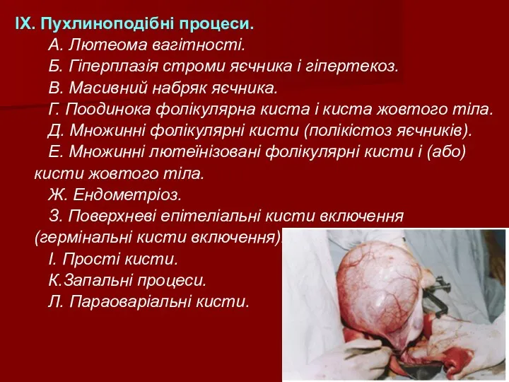 ІХ. Пухлиноподібні процеси. А. Лютеома вагітності. Б. Гіперплазія строми яєчника