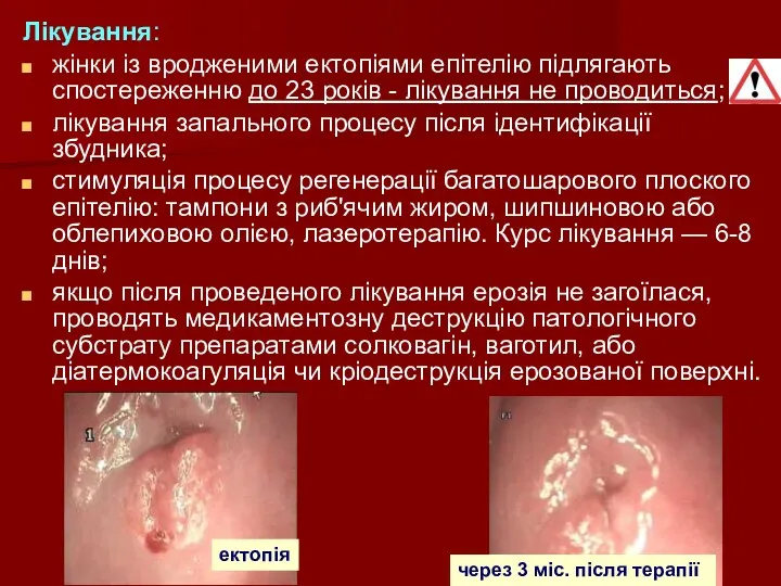 Лікування: жінки із вродженими ектопіями епітелію підлягають спостереженню до 23