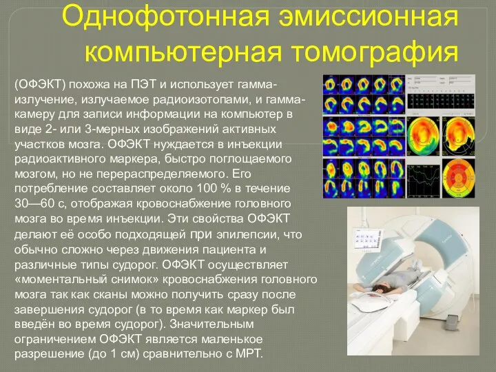 Однофотонная эмиссионная компьютерная томография (ОФЭКТ) похожа на ПЭТ и использует