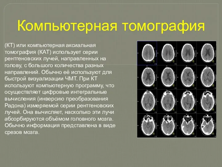 Компьютерная томография (КТ) или компьютерная аксиальная томография (КАТ) использует серии