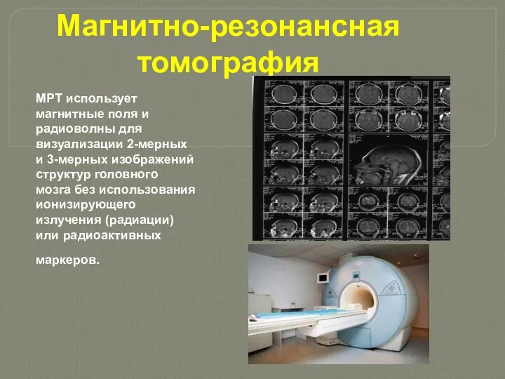 Магнитно-резонансная томография МРТ использует магнитные поля и радиоволны для визуализации