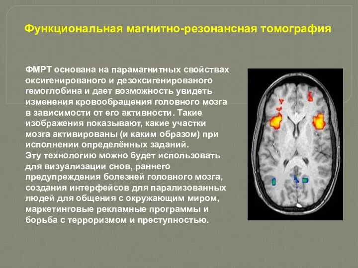 Функциональная магнитно-резонансная томография ФМРТ основана на парамагнитных свойствах оксигенированого и