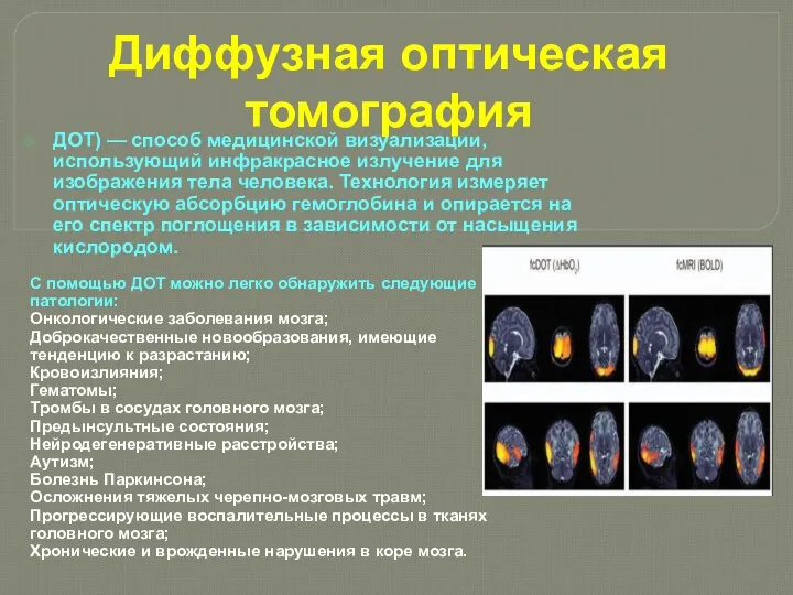 Диффузная оптическая томография С помощью ДОТ можно легко обнаружить следующие