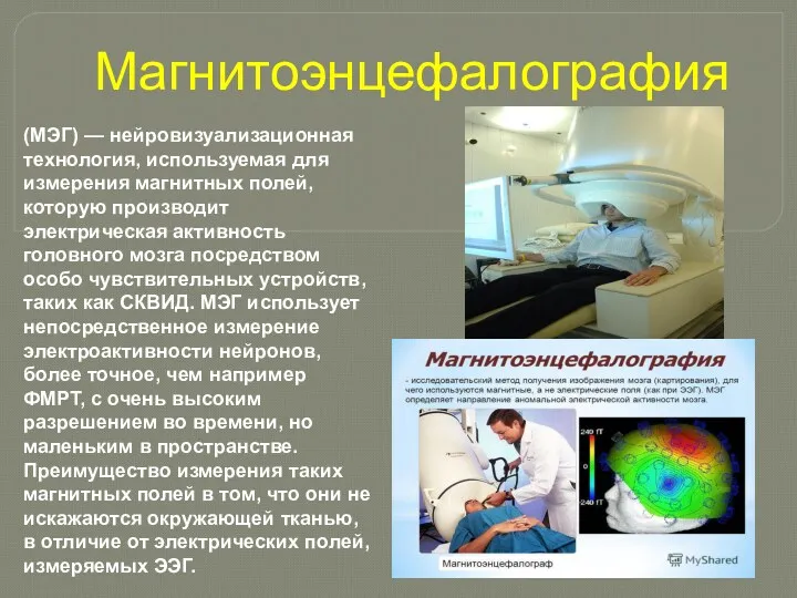 Магнитоэнцефалография (МЭГ) — нейровизуализационная технология, используемая для измерения магнитных полей,