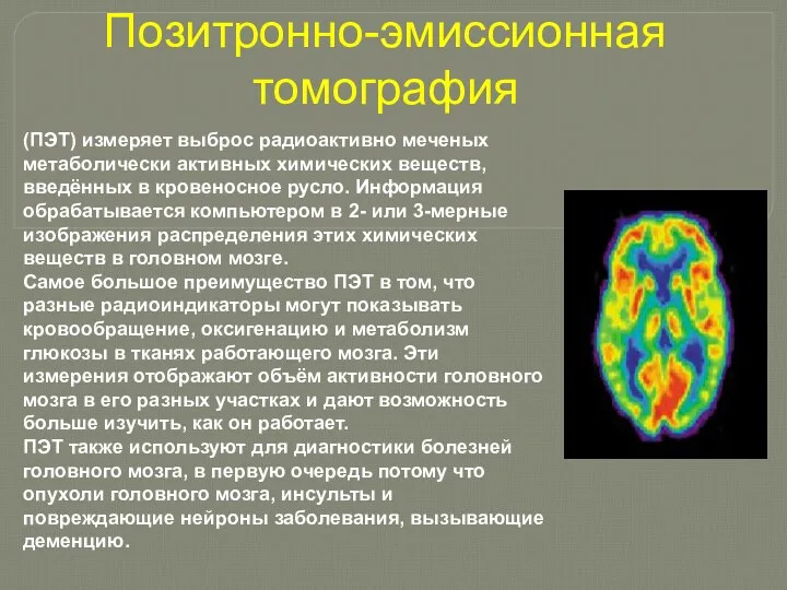 Позитронно-эмиссионная томография (ПЭТ) измеряет выброс радиоактивно меченых метаболически активных химических