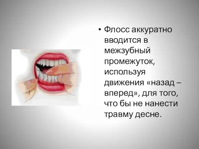 Флосс аккуратно вводится в межзубный промежуток, используя движения «назад –