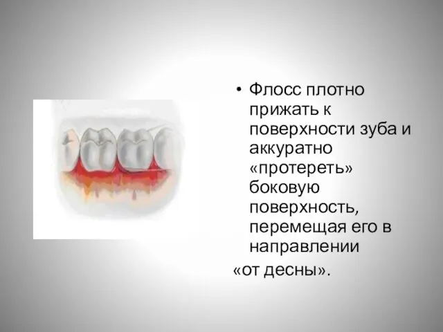 Флосс плотно прижать к поверхности зуба и аккуратно «протереть» боковую