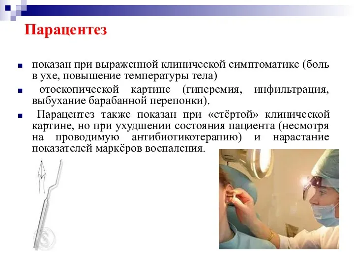 Парацентез показан при выраженной клинической симптоматике (боль в ухе, повышение температуры тела) отоскопической