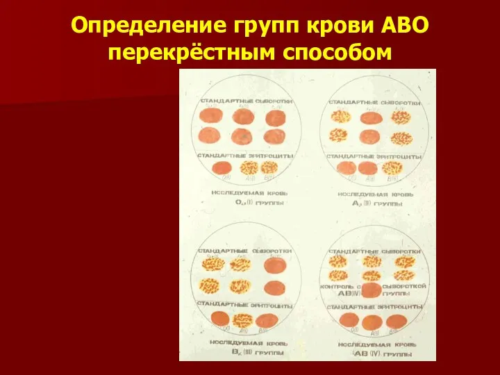 Определение групп крови АВО перекрёстным способом
