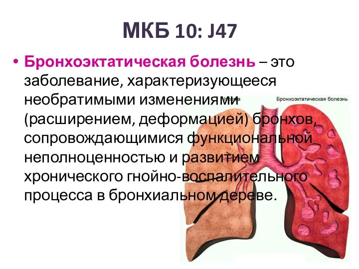 МКБ 10: J47 Бронхоэктатическая болезнь – это заболевание, характеризующееся необратимыми