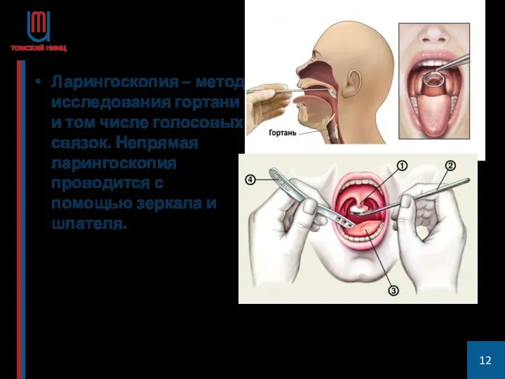 Ларингоскопия – метод исследования гортани и том числе голосовых связок.