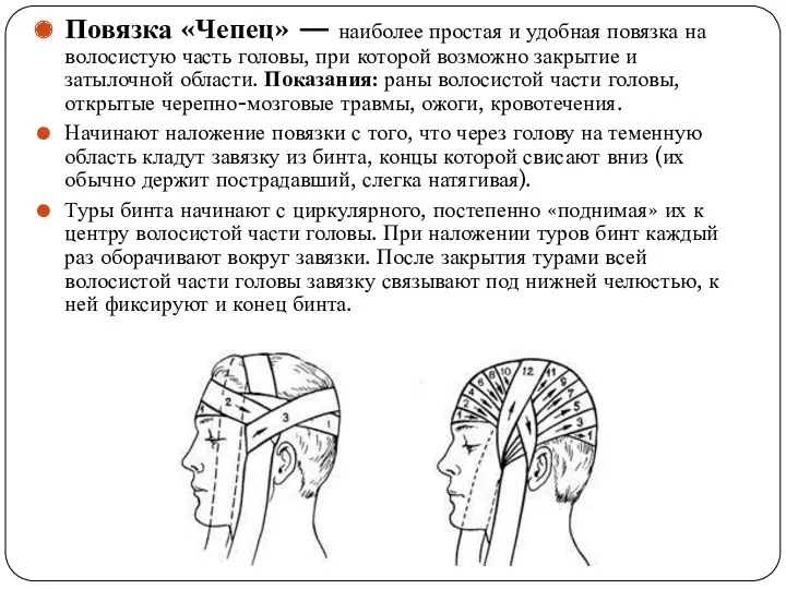 Повязка «Чепец» — наиболее простая и удобная повязка на волосистую часть головы, при