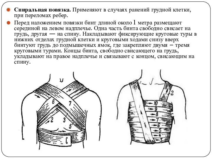 Спиральная повязка. Применяют в случаях ранений грудной клетки, при переломах