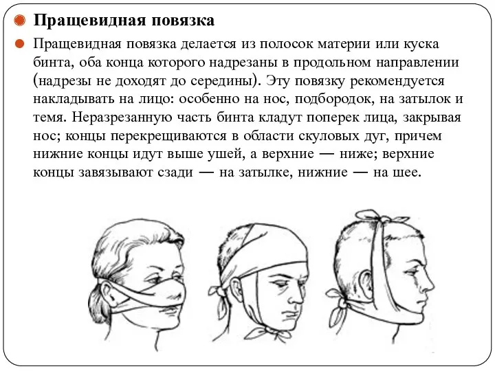 Пращевидная повязка Пращевидная повязка делается из полосок материи или куска бинта, оба конца