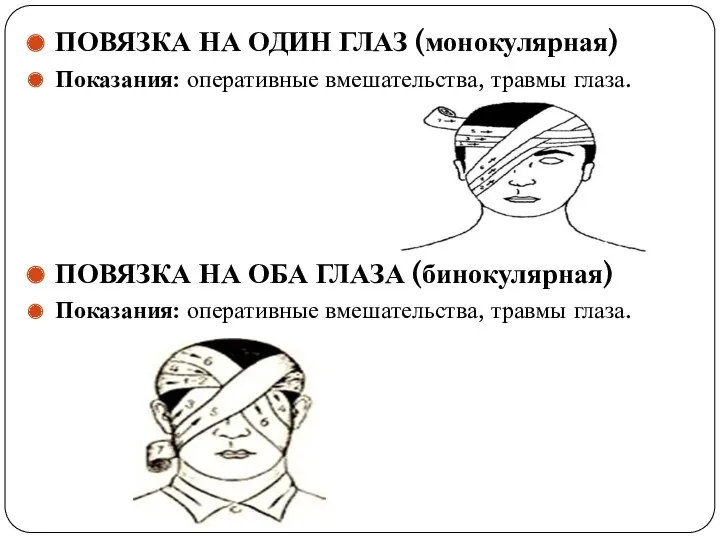 ПОВЯЗКА НА ОДИН ГЛАЗ (монокулярная) Показания: оперативные вмешательства, травмы глаза. ПОВЯЗКА НА ОБА