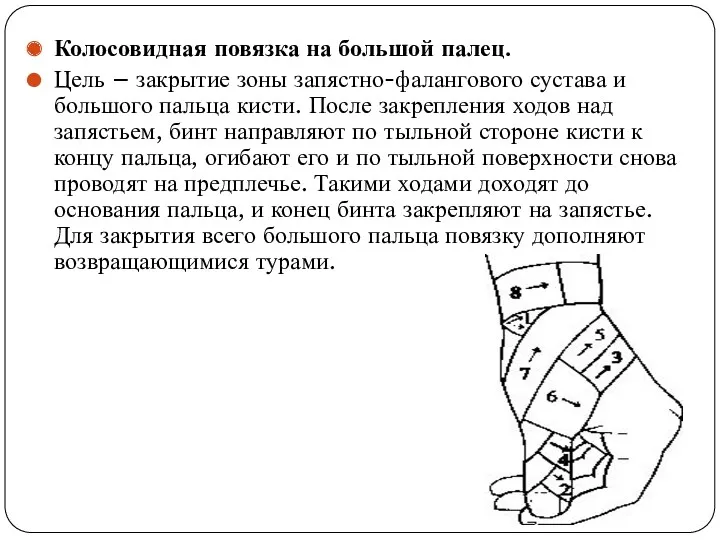 Колосовидная повязка на большой палец. Цель – закрытие зоны запястно-фалангового