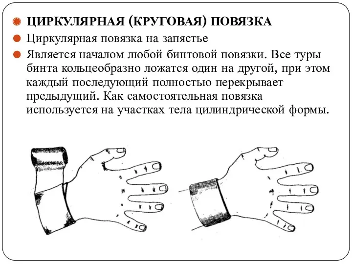 ЦИРКУЛЯРНАЯ (КРУГОВАЯ) ПОВЯЗКА Циркулярная повязка на запястье Является началом любой бинтовой повязки. Все