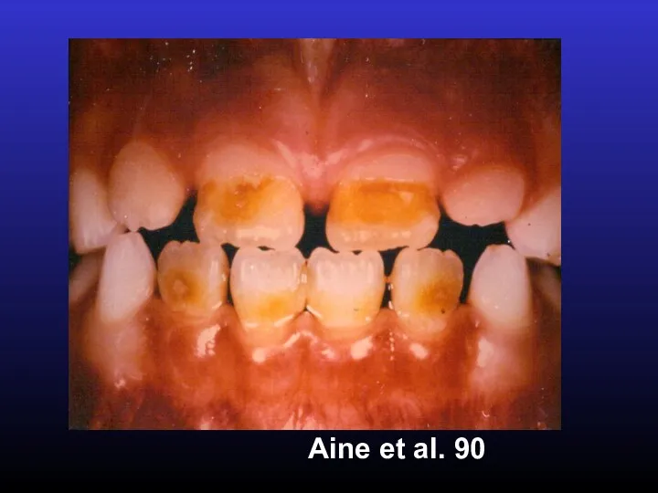 Aine et al. 90