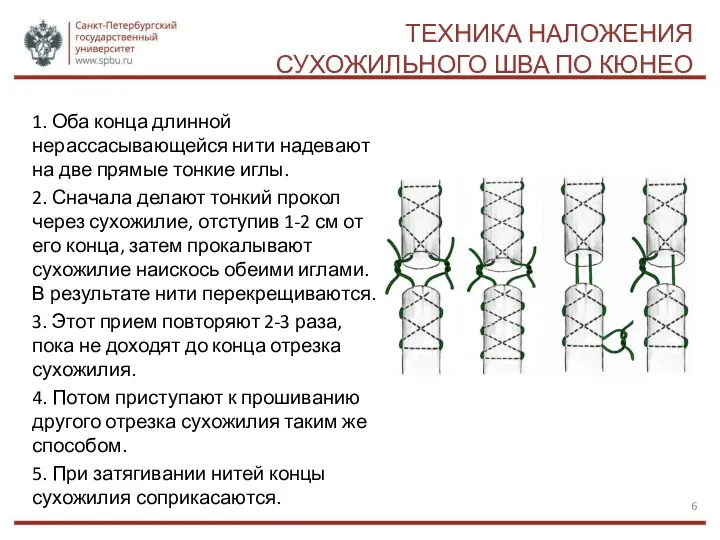 ТЕХНИКА НАЛОЖЕНИЯ СУХОЖИЛЬНОГО ШВА ПО КЮНЕО 1. Оба конца длинной