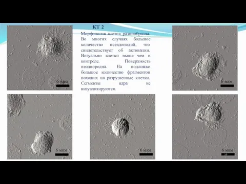 КТ 2 Морфология клеток разнообразна. Во многих случаях большое количество