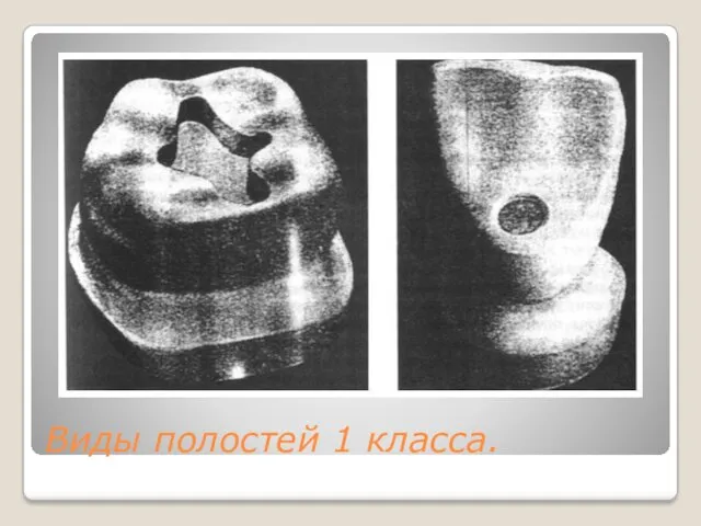 Виды полостей 1 класса.