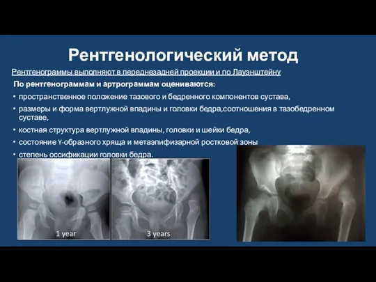 Рентгенологический метод Рентгенограммы выполняют в переднезадней проекции и по Лауэнштейну