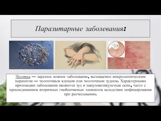Паразитарные заболевания: Чесотка — заразное кожное заболевание, вызываемое микроскопическим паразитом