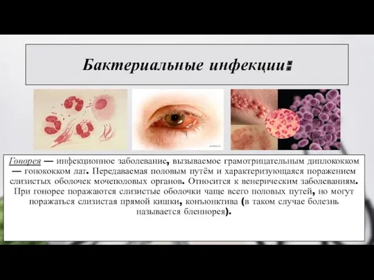 Бактериальные инфекции: Гонорея — инфекционное заболевание, вызываемое грамотрицательным диплококком —