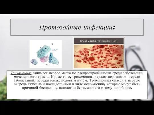 Протозойные инфекции: Трихомониаз занимает первое место по распространённости среди заболеваний