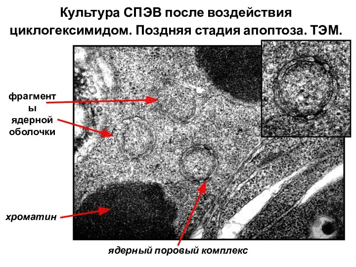 Культура СПЭВ после воздействия циклогексимидом. Поздняя стадия апоптоза. ТЭМ. хроматин фрагменты ядерной оболочки ядерный поровый комплекс