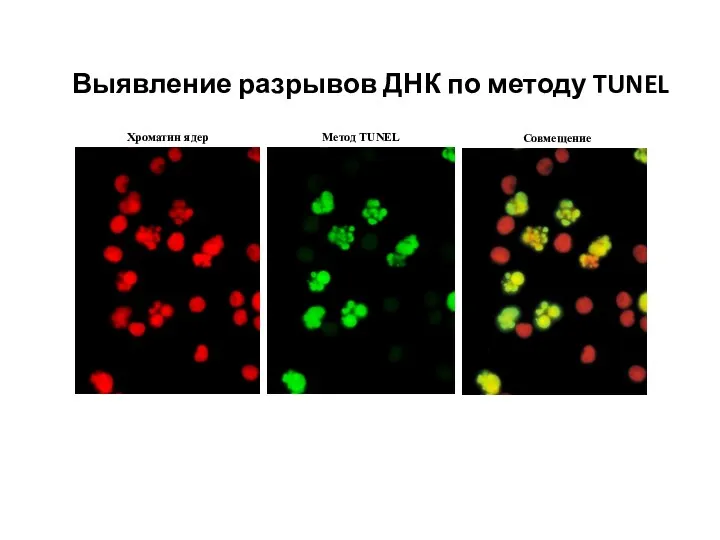 Выявление разрывов ДНК по методу TUNEL Хроматин ядер Метод TUNEL Совмещение