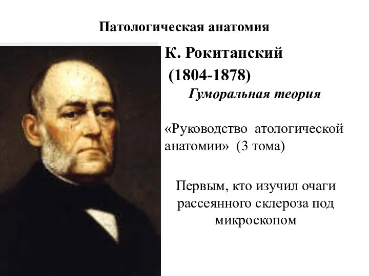 Патологическая анатомия Гуморальная теория К. Рокитанский (1804-1878) «Руководство атологической анатомии»