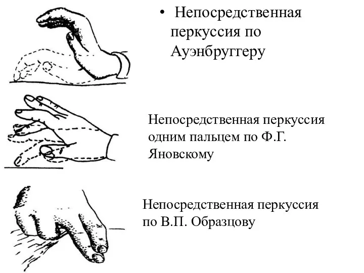 Непосредственная перкуссия по Ауэнбруггеру Непосредственная перкуссия одним пальцем по Ф.Г. Яновскому Непосредственная перкуссия по В.П. Образцову
