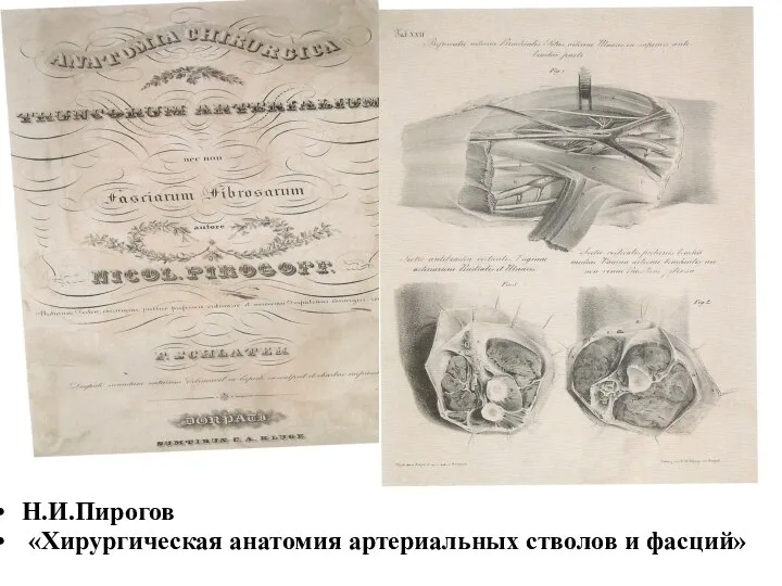 Н.И.Пирогов «Хирургическая анатомия артериальных стволов и фасций»