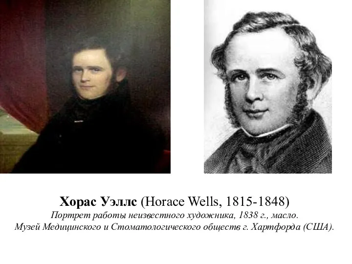 Хорас Уэллс (Horace Wells, 1815-1848) Портрет работы неизвестного художника, 1838