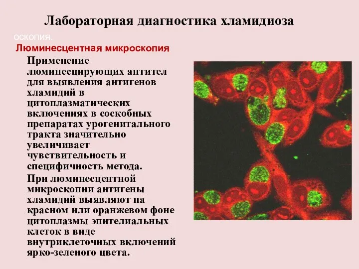 Лабораторная диагностика хламидиоза оскопия. Люминесцентная микроскопия Применение люминесцирующих антител для выявления антигенов хламидий