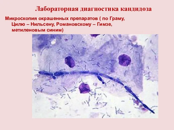 Лабораторная диагностика кандидоза Микроскопия окрашенных препаратов ( по Граму, Цилю – Нильсену, Романовскому