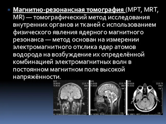 Магнитно-резонансная томография (МРТ, MRT, MR) — томографический метод исследования внутренних органов и тканей