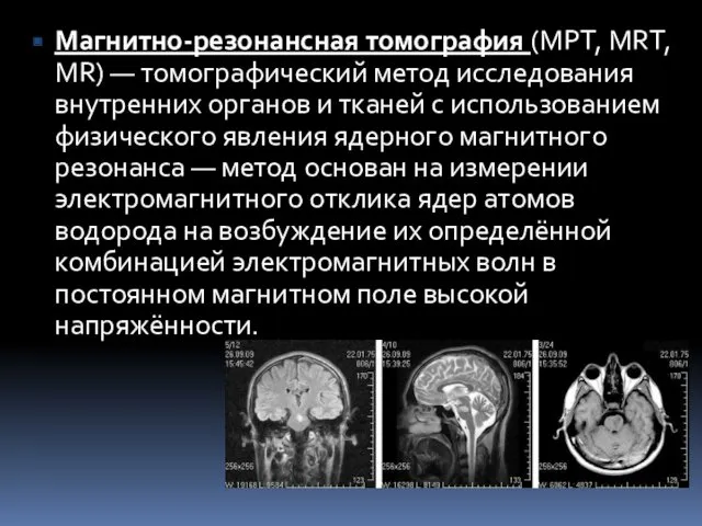 Магнитно-резонансная томография (МРТ, MRT, MR) — томографический метод исследования внутренних