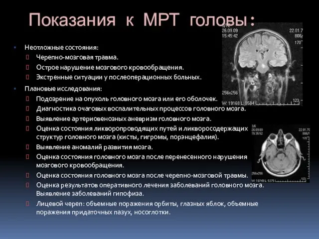 Показания к МРТ головы: Неотложные состояния: Черепно-мозговая травма. Острое нарушение мозгового кровообращения. Экстренные