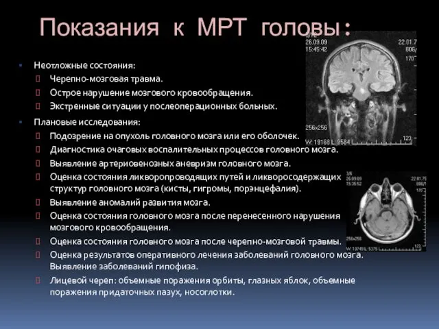 Показания к МРТ головы: Неотложные состояния: Черепно-мозговая травма. Острое нарушение