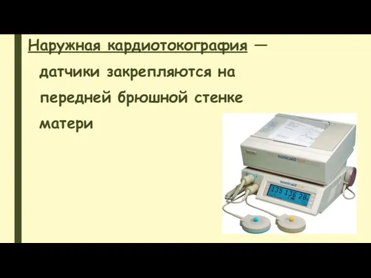 Наружная кардиотокография — датчики закрепляются на передней брюшной стенке матери