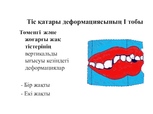 Тіс қатары деформациясының I тобы Төменгі және жоғарғы жақ тістерінің