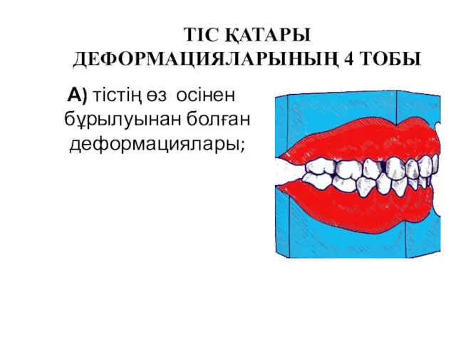 ТІС ҚАТАРЫ ДЕФОРМАЦИЯЛАРЫНЫҢ 4 ТОБЫ А) тістің өз осінен бұрылуынан болған деформациялары;