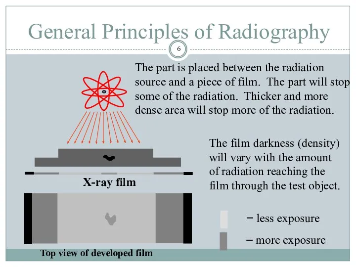 General Principles of Radiography Top view of developed film X-ray