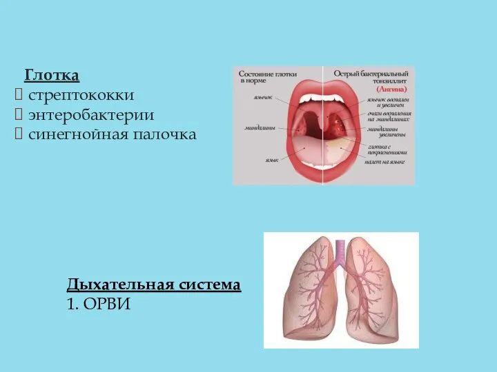 Глотка стрептококки энтеробактерии синегнойная палочка Дыхательная система 1. ОРВИ