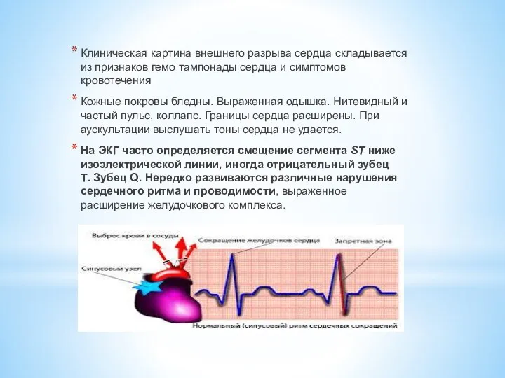Клиническая картина внешнего разрыва сердца складывается из признаков гемо тампонады сердца и симптомов